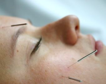 Gesichtsverjungung 2